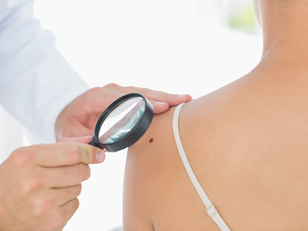 眼瞼下垂・いぼなどの日帰り手術